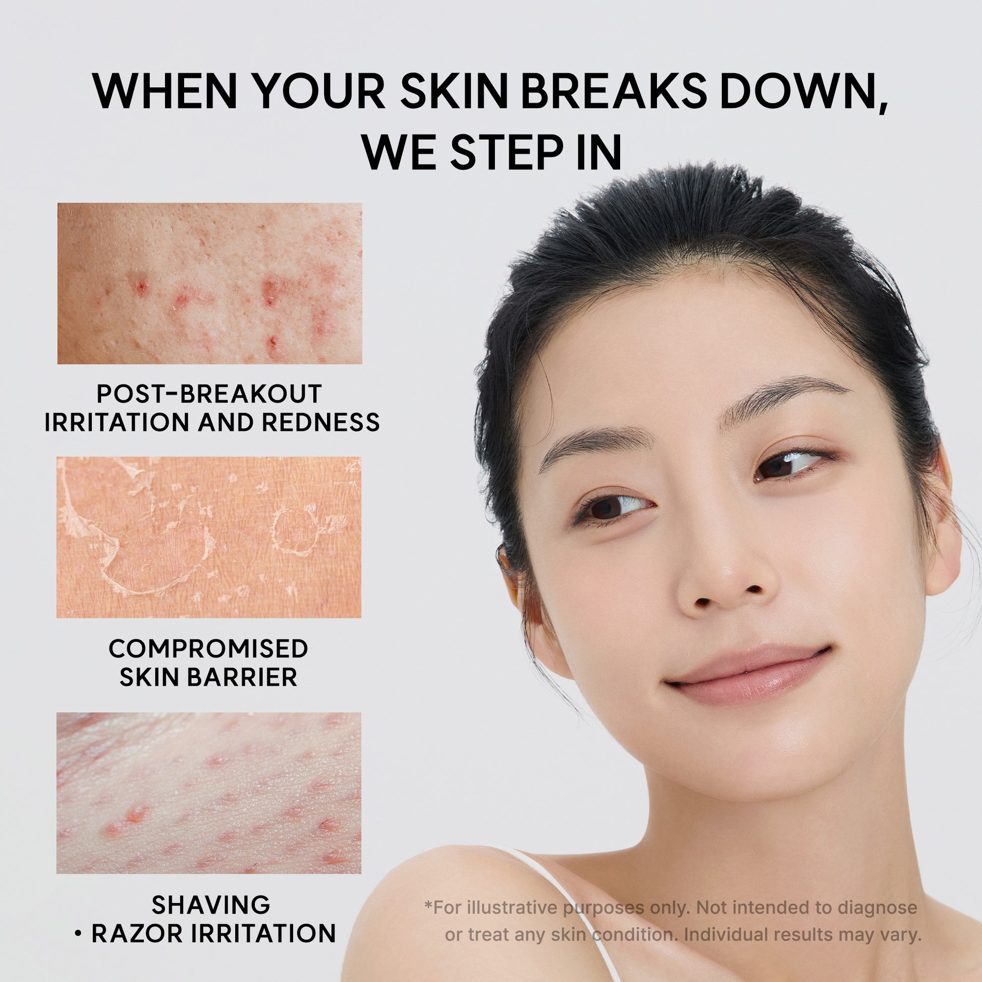 Eraser Skin Reset Trio
