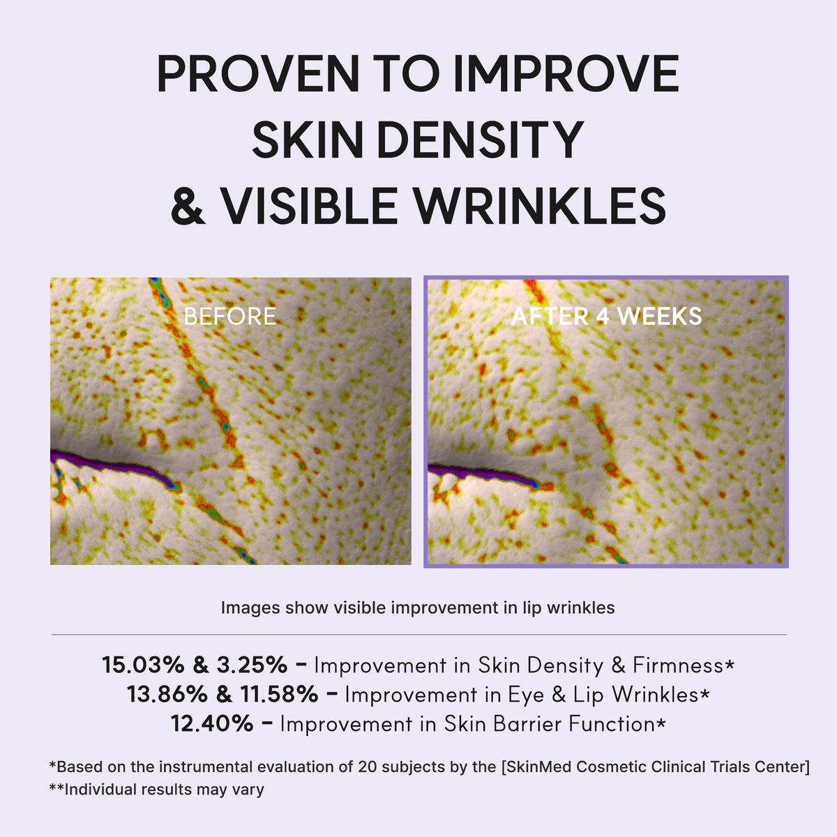 Four-week clinical before-and-after skin scans for Arencia NAD+ Booster Shot: 15.03% skin density, 3.25% firmness, 13.86% eye wrinkle, 11.58% lip wrinkle and 12.40% barrier improvements.