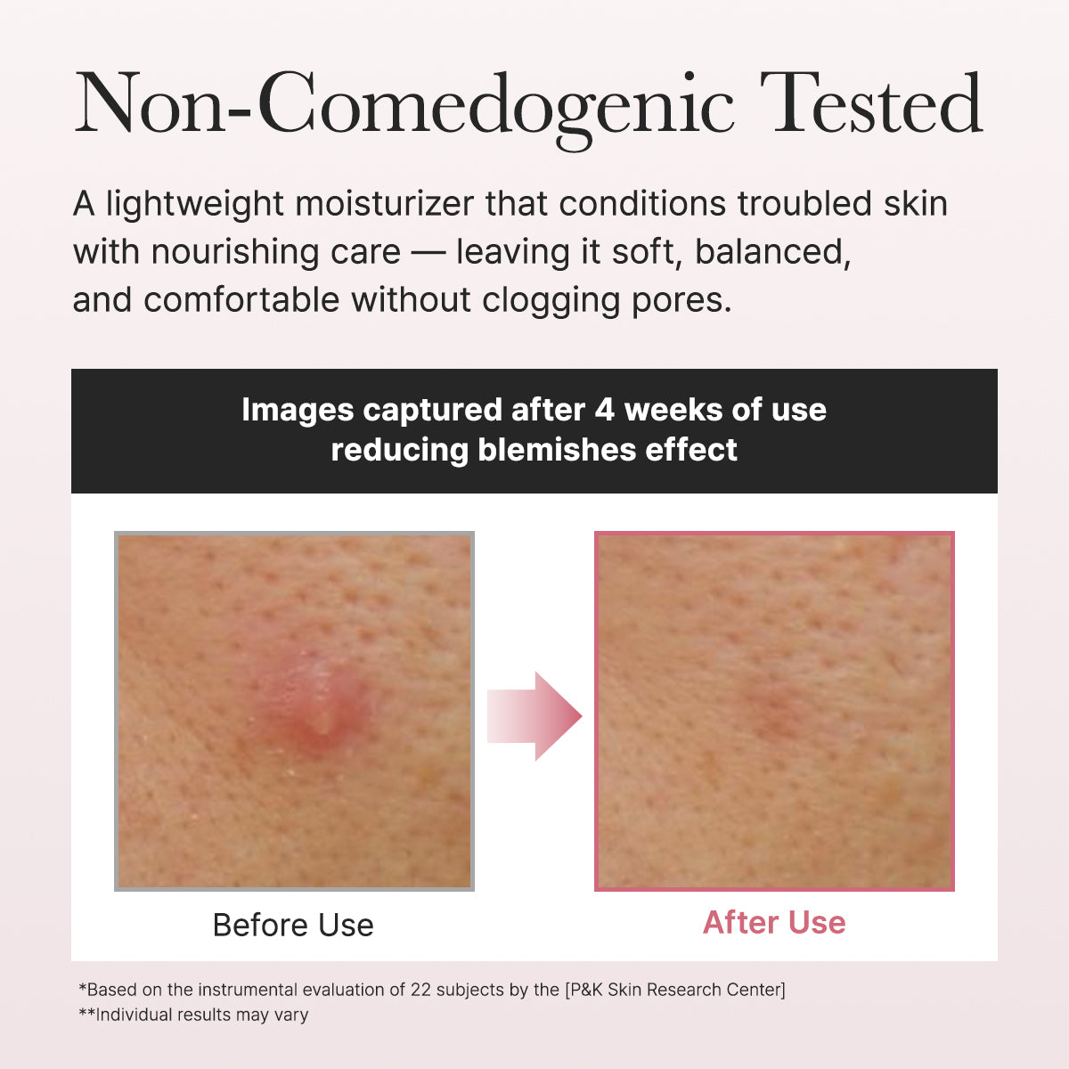 Red Smoothie Face Lotion Moisturizer 5, Niacinamide 5% & Collagen for daily bouncy, glowy skin care