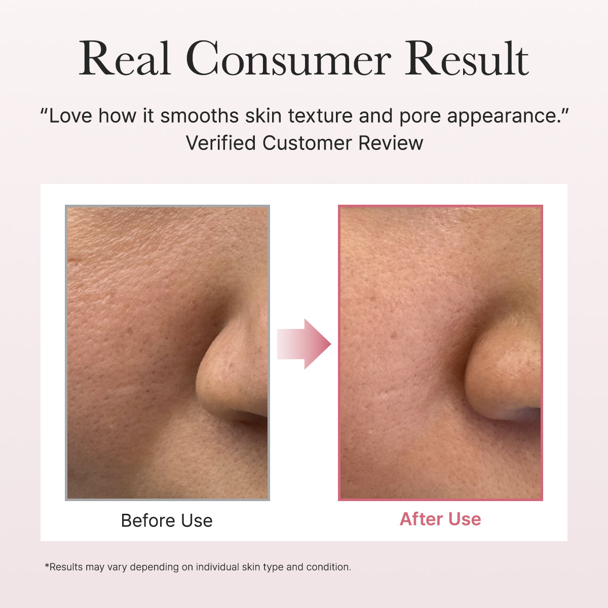 Red Smoothie Face Lotion Moisturizer 5, Niacinamide 5% & Collagen for daily bouncy, glowy skin care