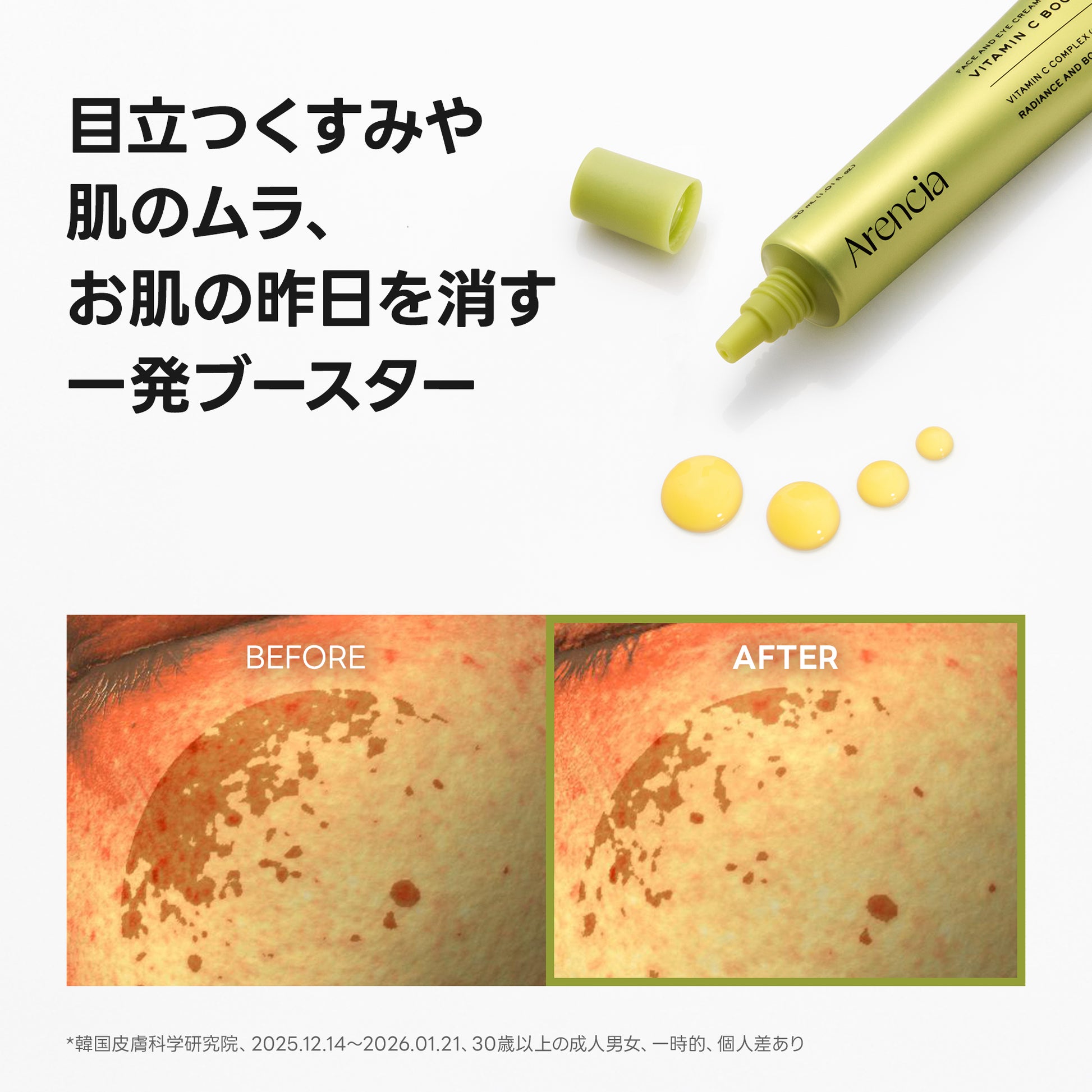 アレンシア ビタミンCブースターショット 30ml, 10ml