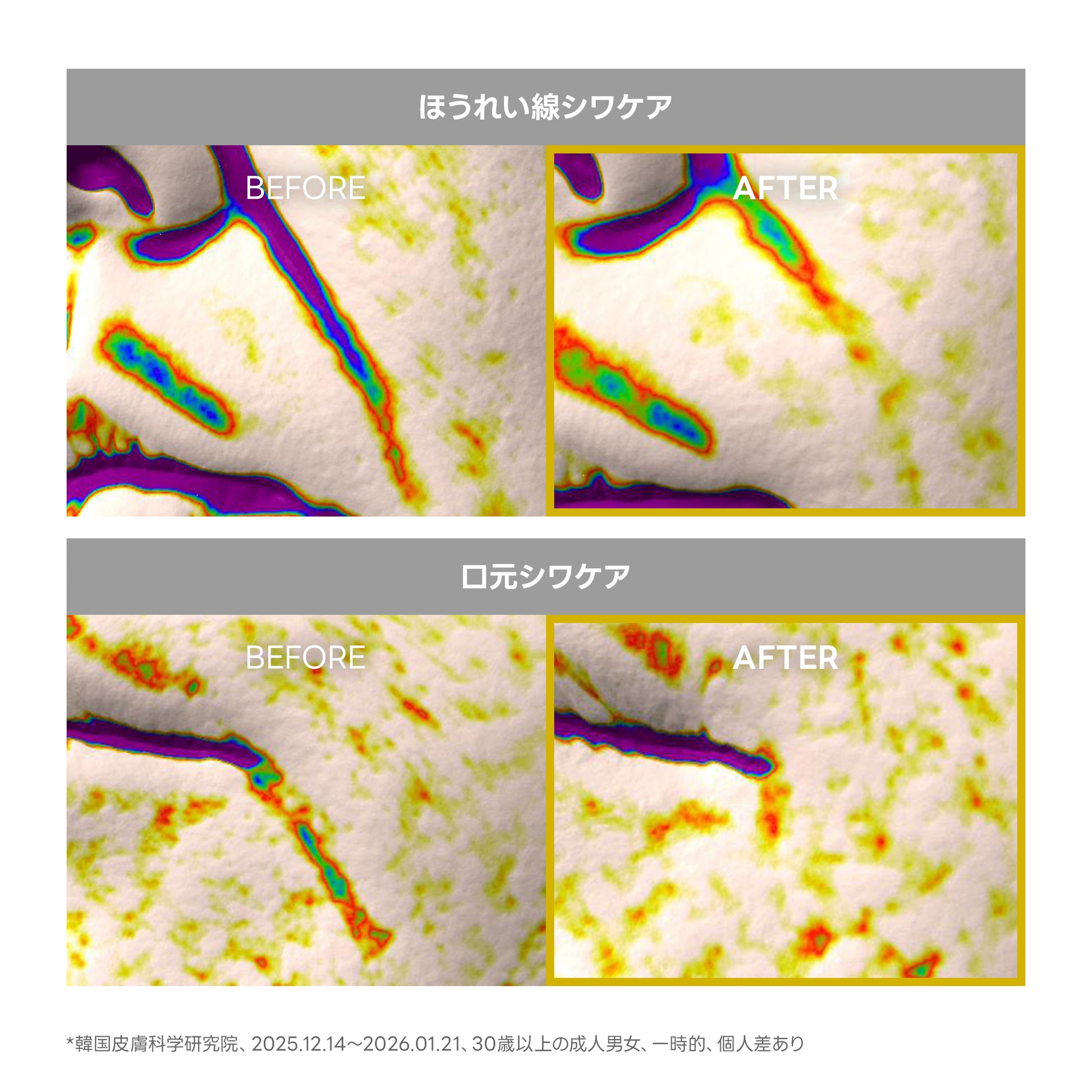 アレンシア レチナールブースターショット 30ml